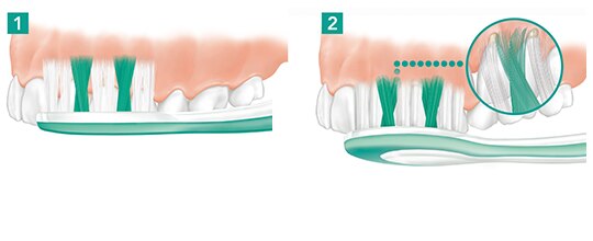 Ilustrace správné techniky čištění zubů kartáčkem.